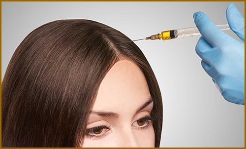 Treatment of hair loss with hair mesotherapy and the durability of its results