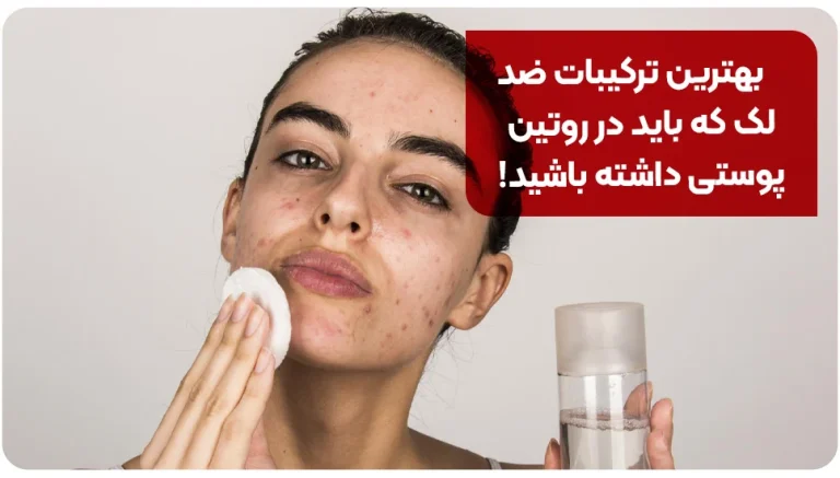 بهترین ترکیبات ضد لک که باید در روتین پوستی داشته باشید!