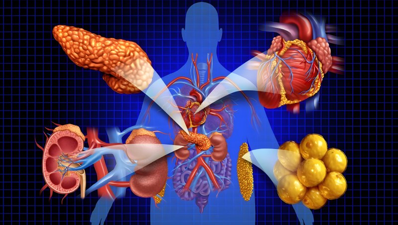 سندروم خاموش قلب، کلیه و متابولیک؛ خطری که ۹۰٪ افراد را تهدید می‌ کند